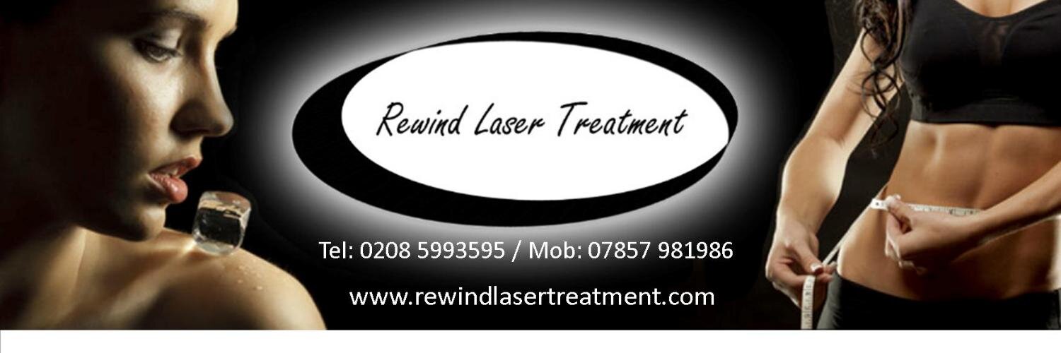RewindLaser's profile banner image