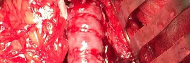 Patrick Vriens banner