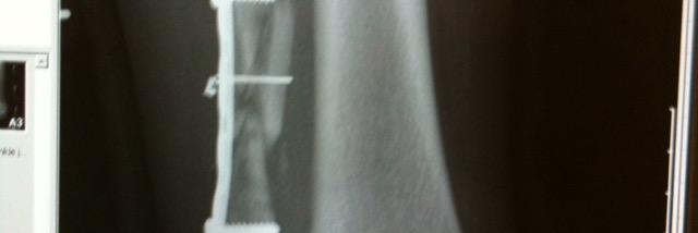 Tony leatherbarrow banner