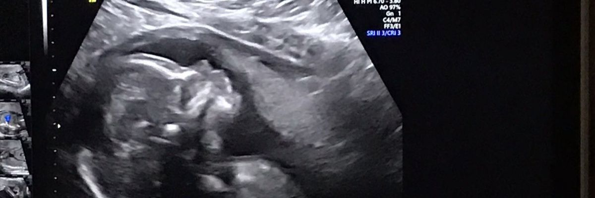 brisatorres25's profile banner image