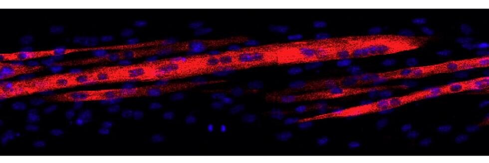 Acta Biomaterialia's banner