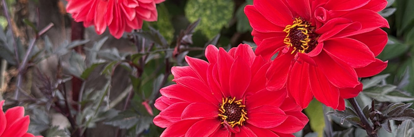 𝑨 𝒍 𝒆 🩷 banner