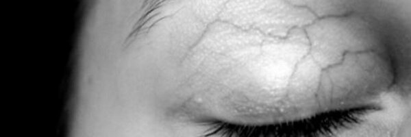 Impsn Profile Banner