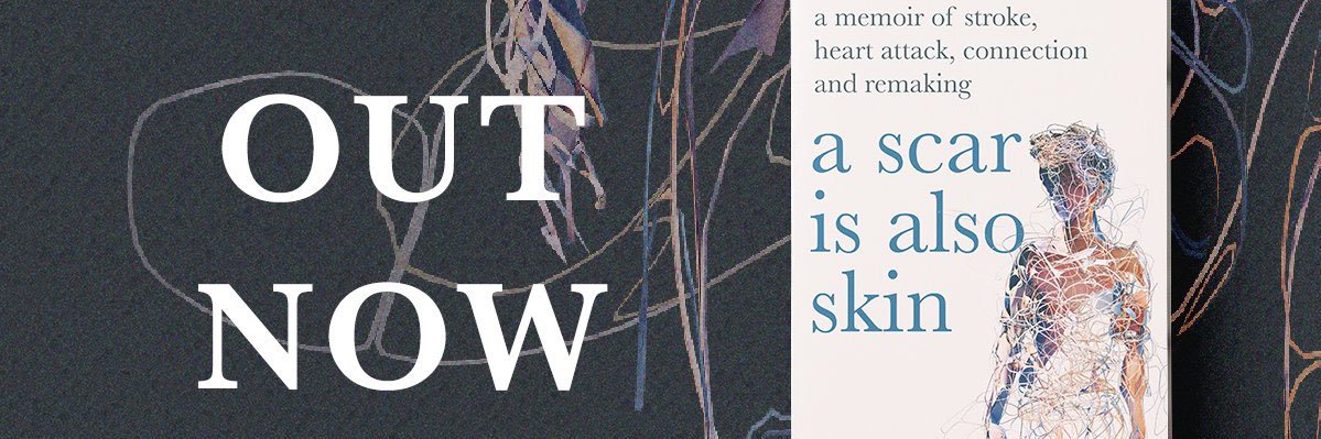 Ben Mckelvey's banner
