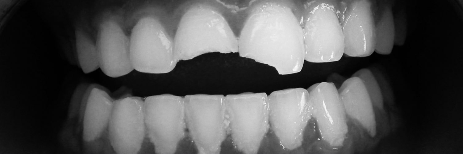 PaidInTeeth's profile banner image