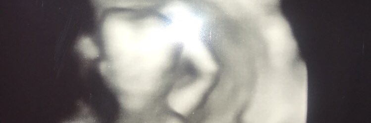 DariusOnly1's profile banner image