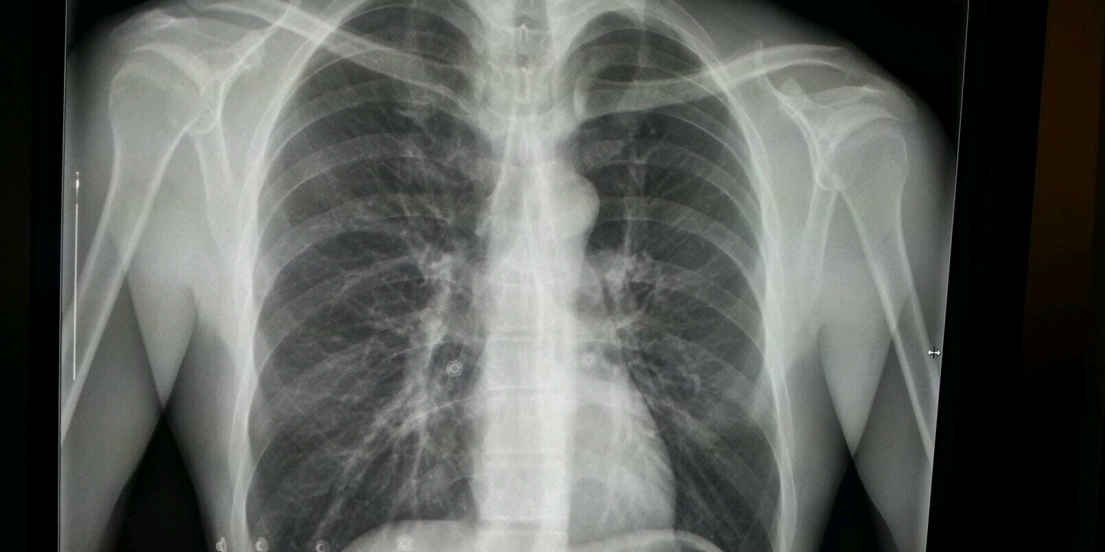 Rashid Akhtar banner