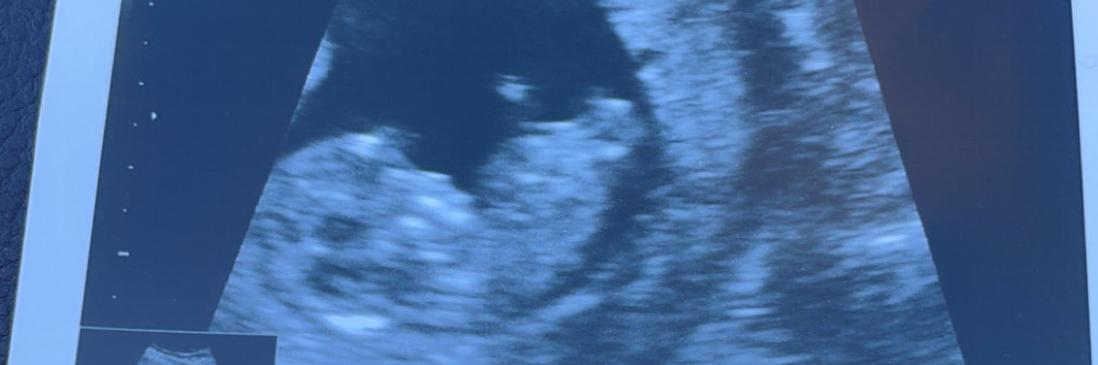 __jthomason's profile banner image