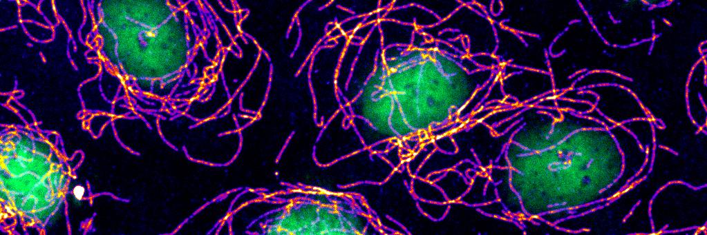 Jonathan Lawson banner