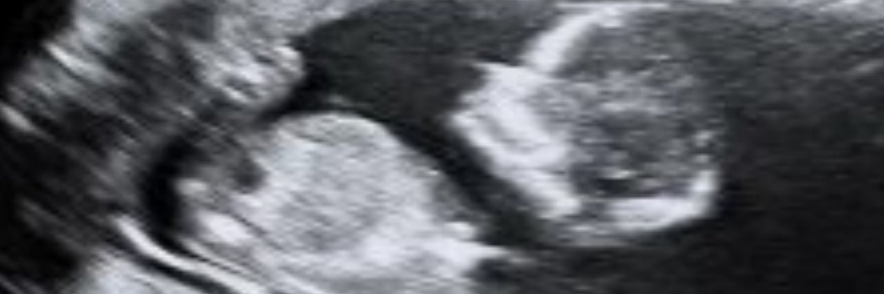Detnee1's profile banner image