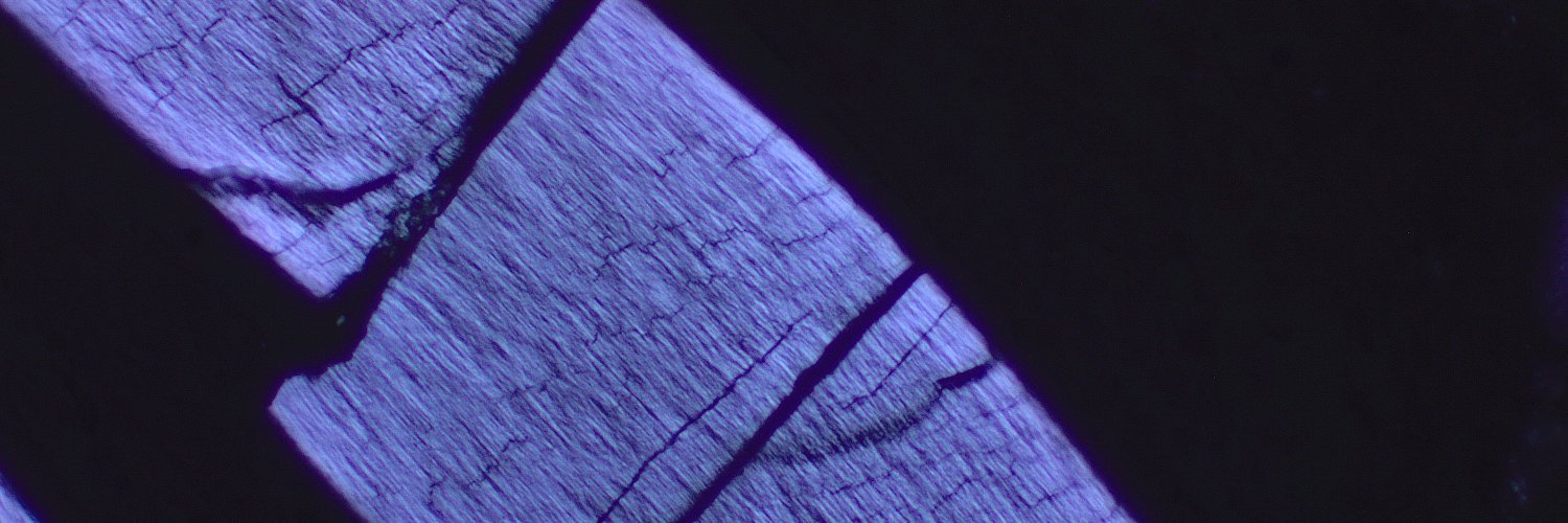 Tyler Teichmeier M.D., MLS(ASCP) banner