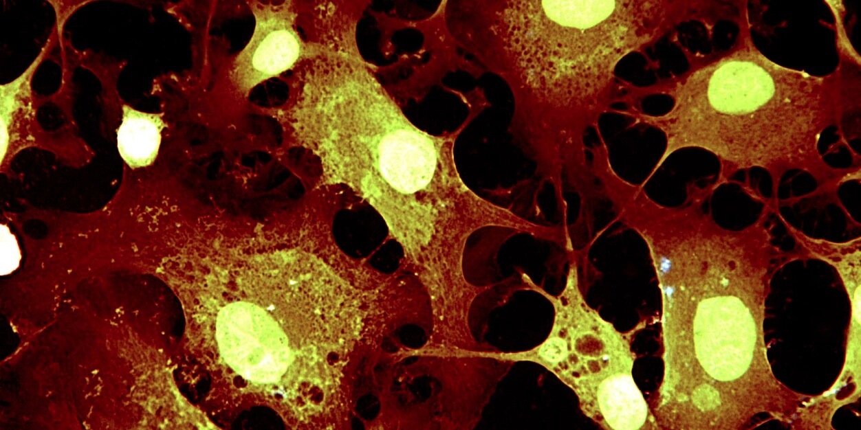 Dr. María D. Mayán banner