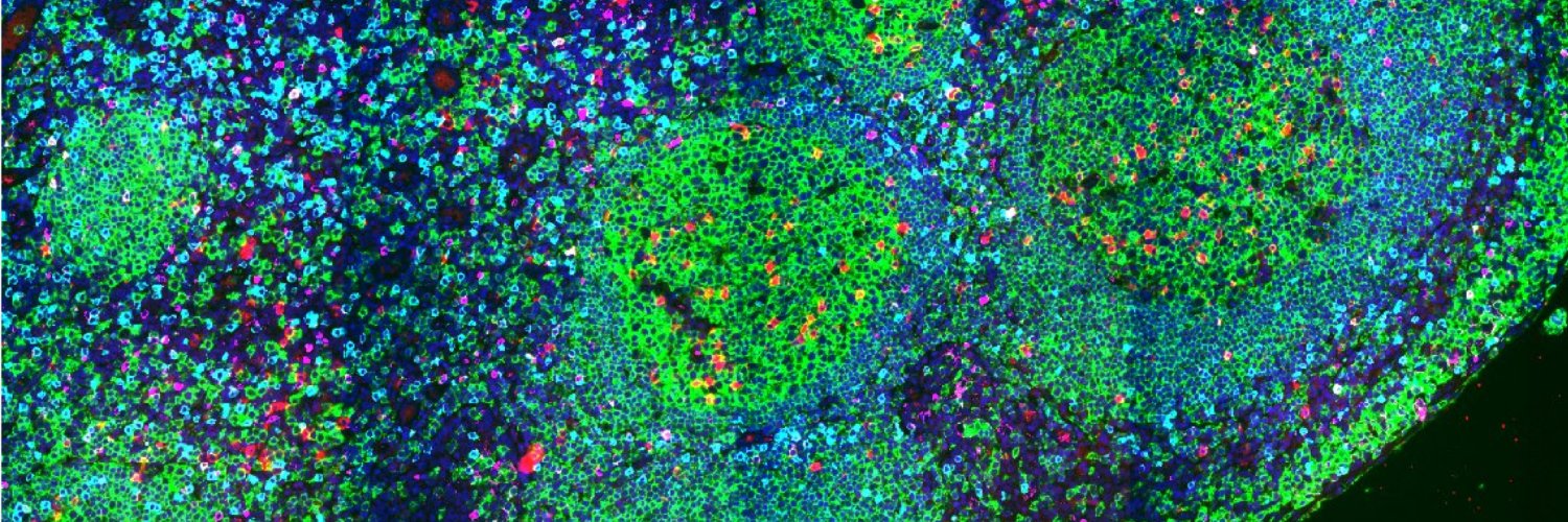 Vignesh Shanmugam banner