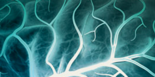 OvercomeStroke's profile banner image