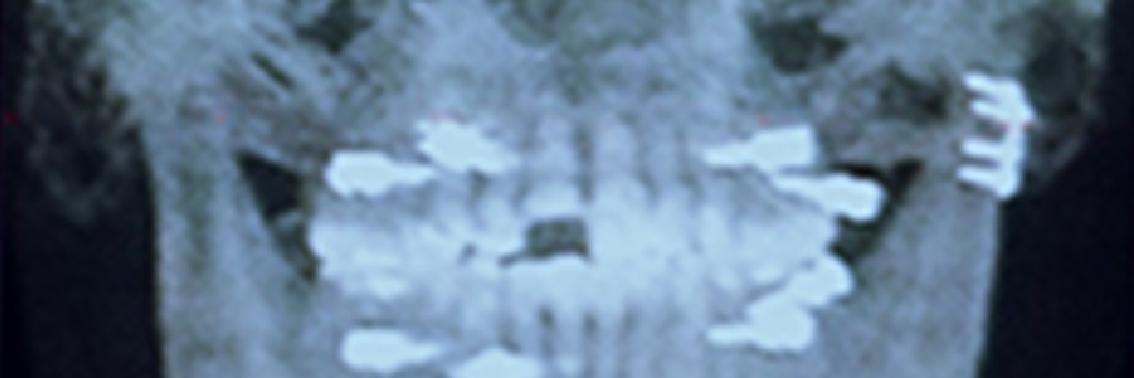 ANJ_Gaming's profile banner image