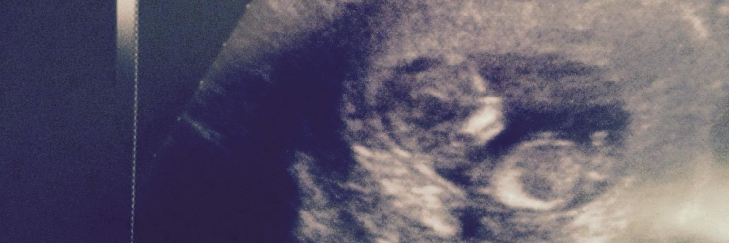 CambrianCarr's profile banner image