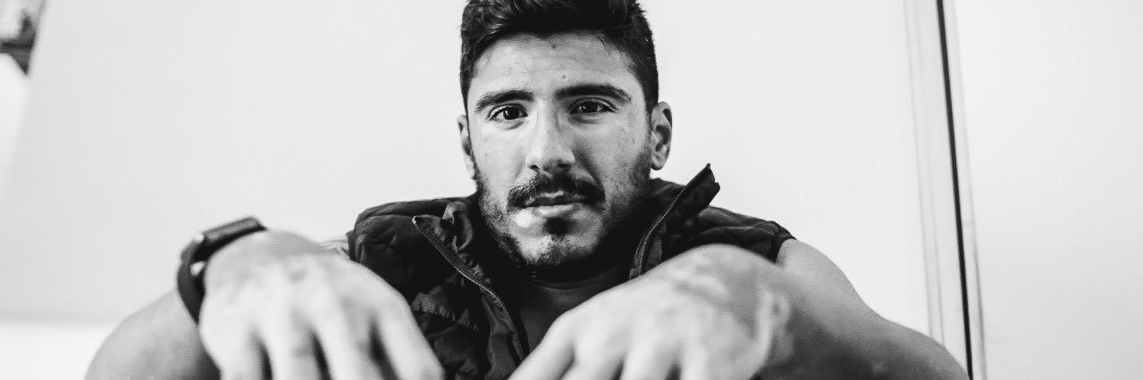 Diego Kydo 🐼 #vitiligo banner