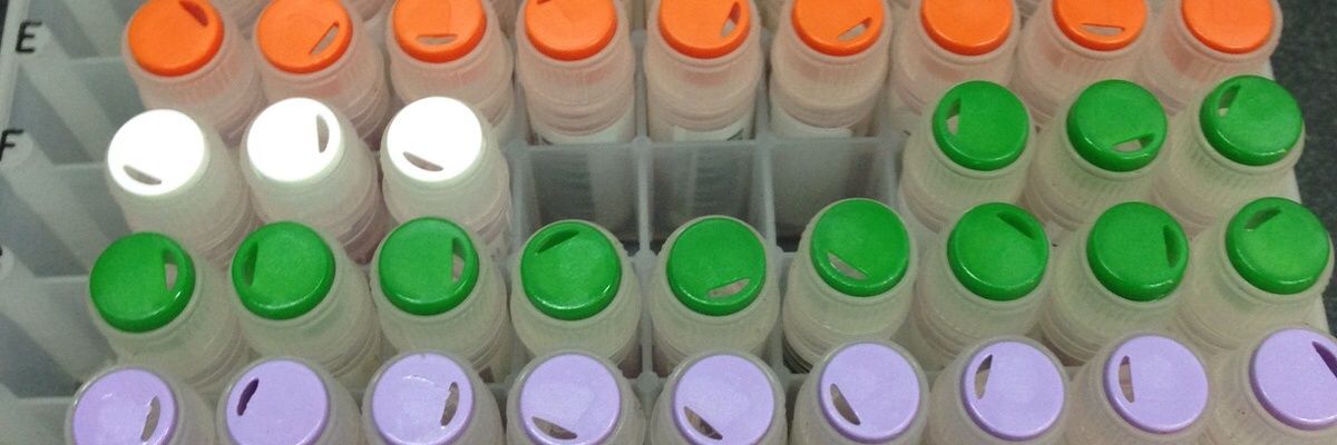 Prof Eric Fevre banner