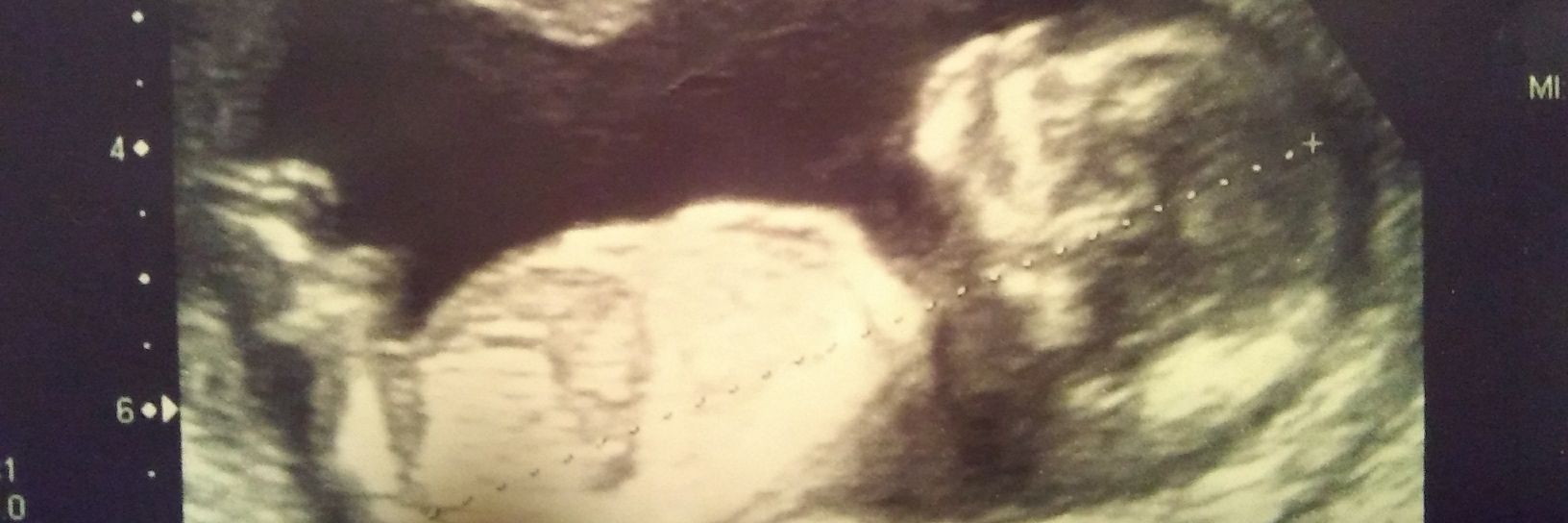 EduuCardozoo's profile banner image