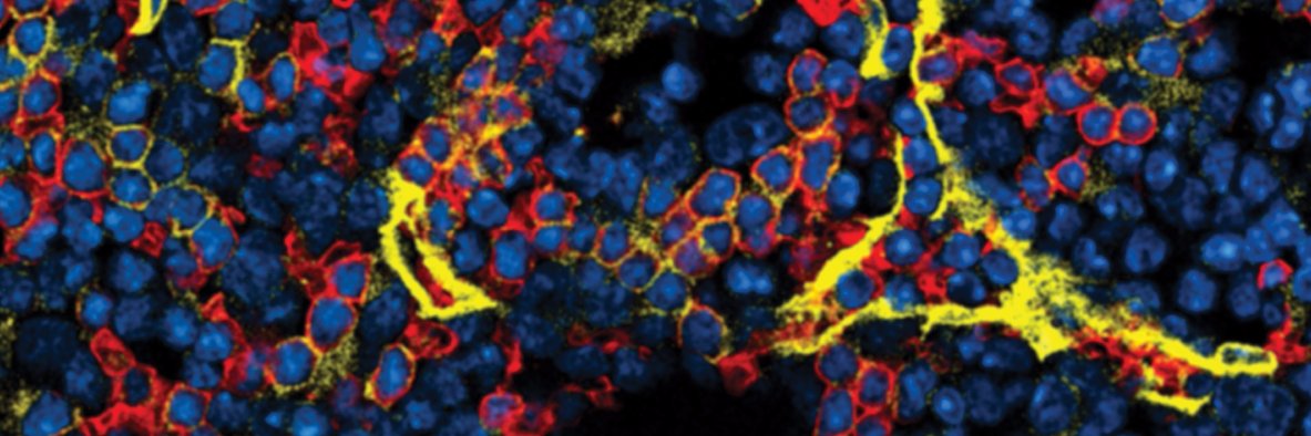 Johan Duchene banner