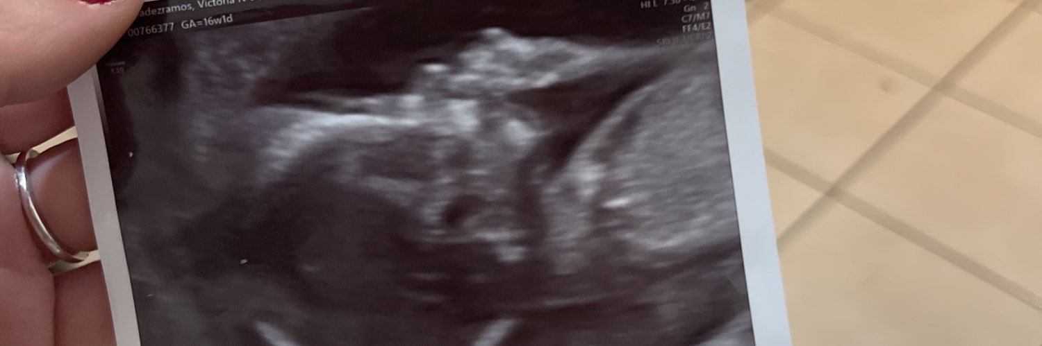 dimples_torri's profile banner image
