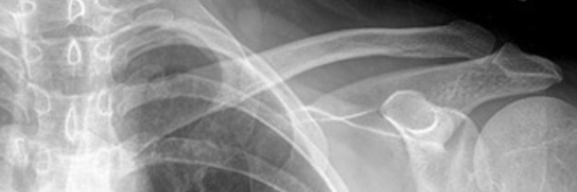 theALSRT's profile banner image