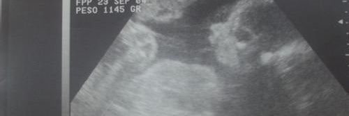pinkysanz's profile banner image