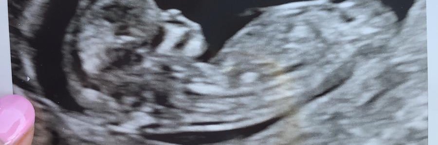 Sammy Mc banner