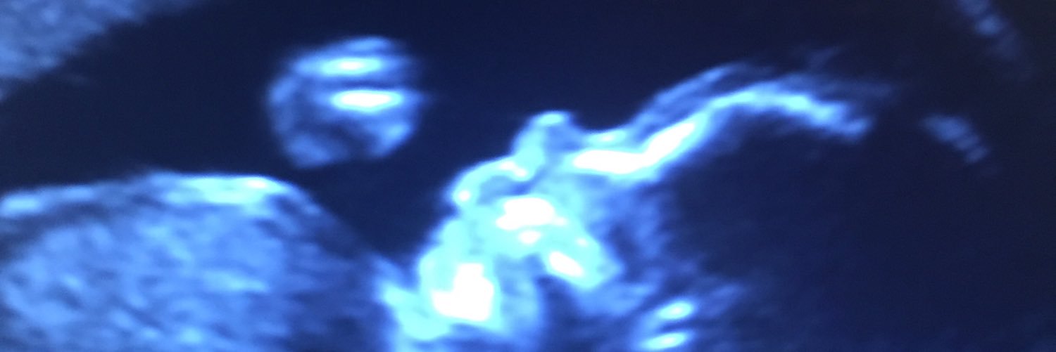 EmmaJayne3000's profile banner image
