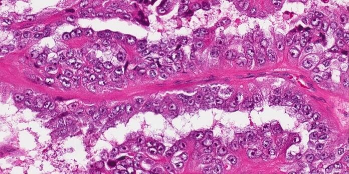 Matthew Wasco banner