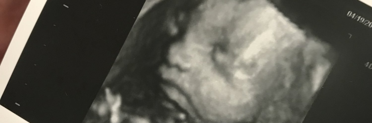 Jeremyschwart14's profile banner image