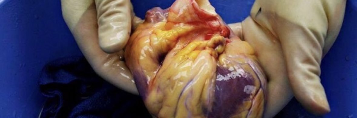 Michael O. Zembala banner