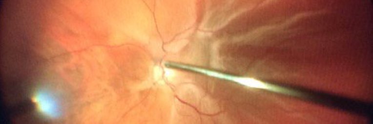 VisionSurgical's profile banner image