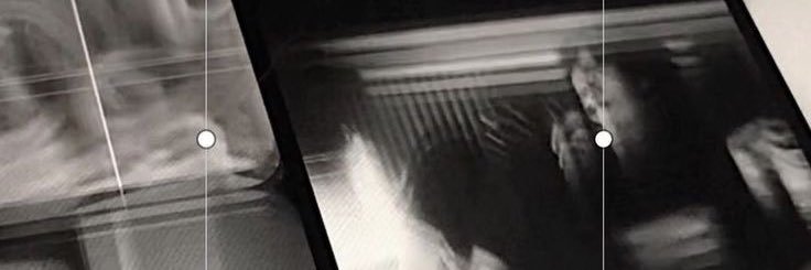 chia — mt after dm banner