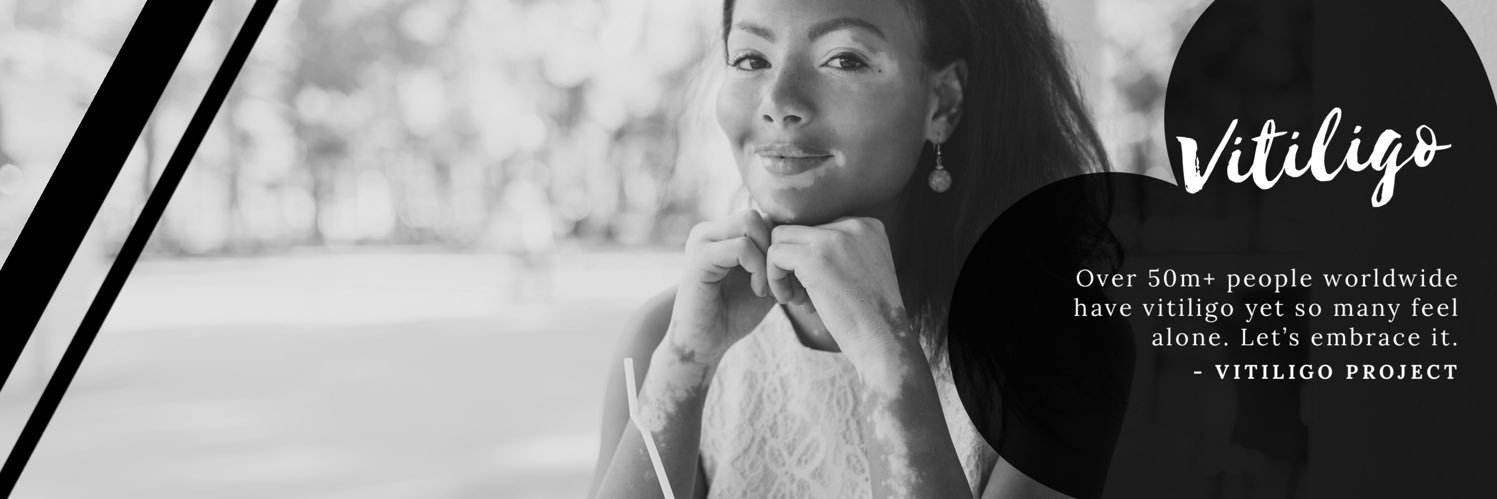 Vitiligo Project banner