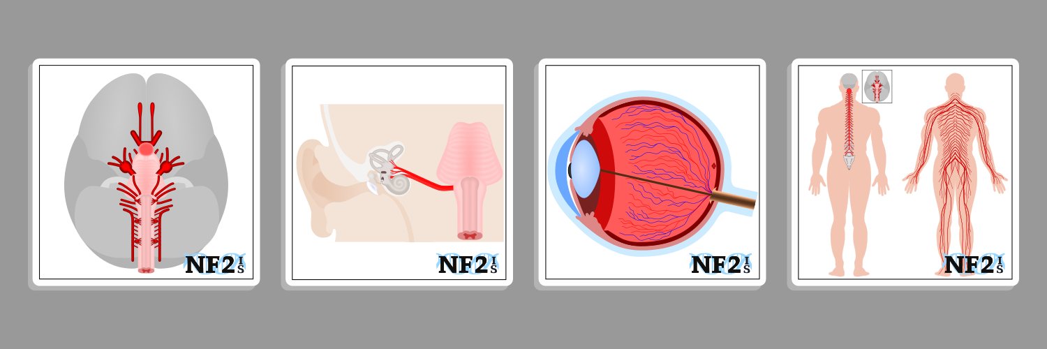 NF2 Info. & Services banner