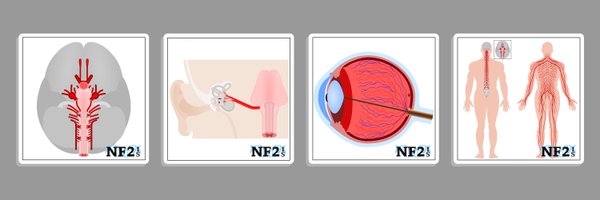 NF2_IS Profile Banner