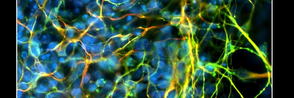 Franklin West banner