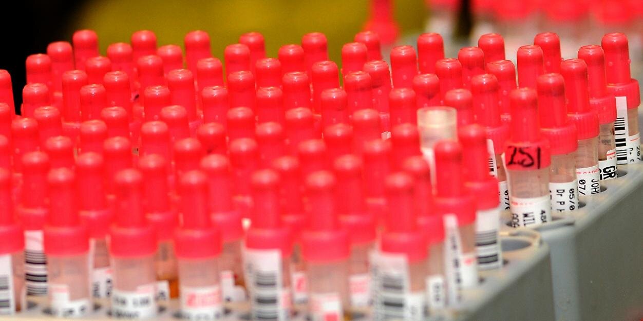 Exeter Clinical Laboratory banner