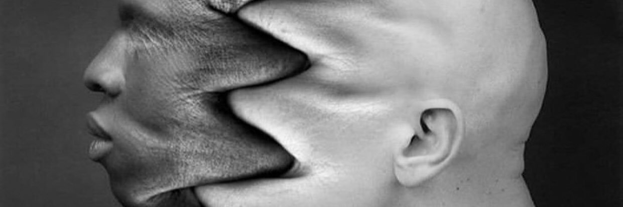 Sigmoid Froid banner