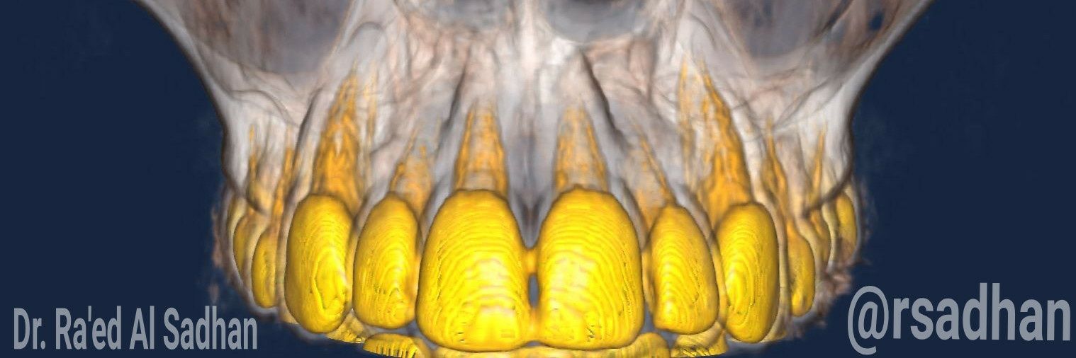 رائد السدحان rsadhan banner