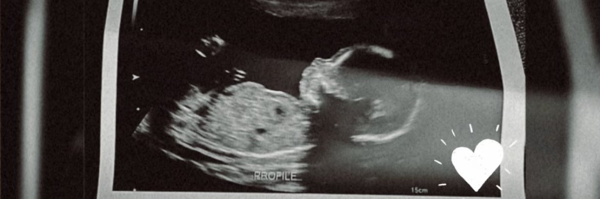 Babygirl ✗♥o banner