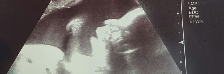 calvo0972's profile banner image