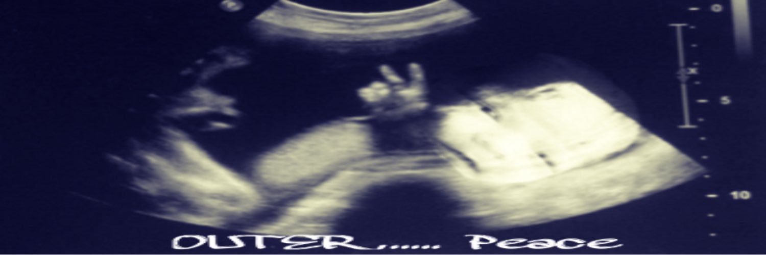 OuterSerkle's profile banner image