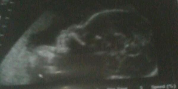Simply_BEE's profile banner image