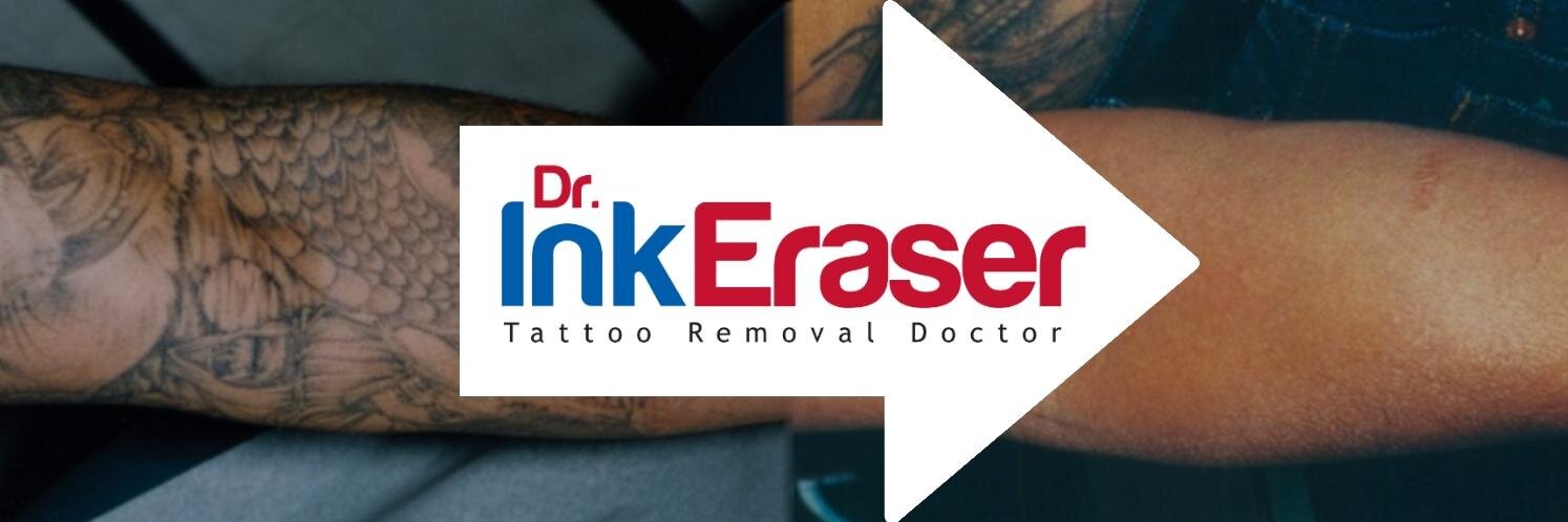 tattooremovalga's profile banner image
