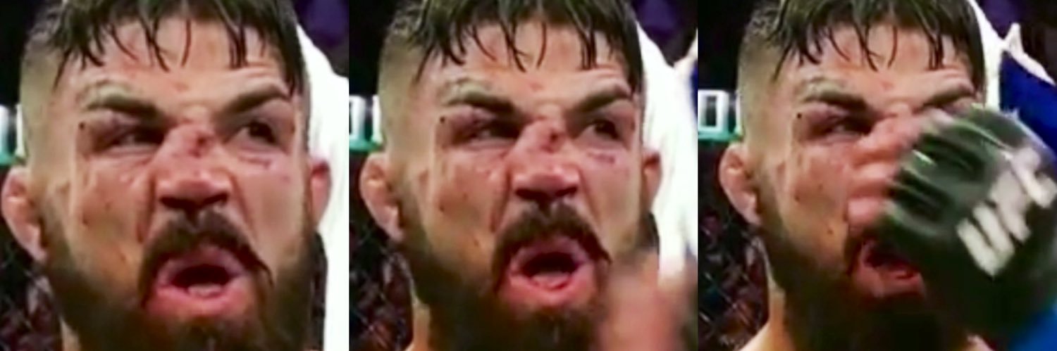Mike Perry’s Nose👃 banner