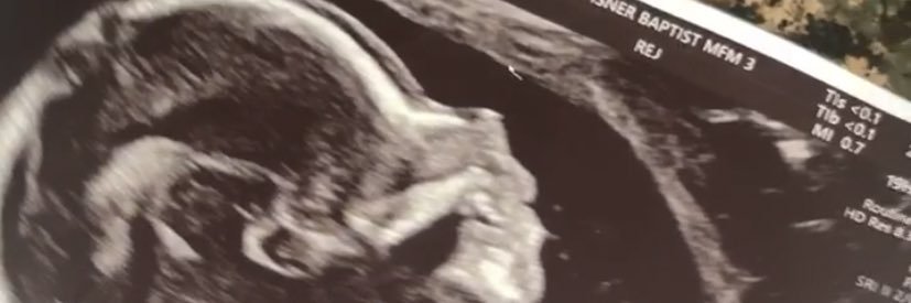 pparriss_'s profile banner image