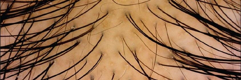 AndroAlopecia's profile banner image