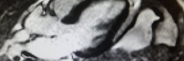 MasriAhmadMD Profile Banner